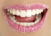 Fall in Love with a New Smile at Robert Stoner Orthodontics