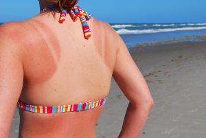 Sun Safety