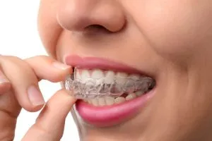 Invisalign Smile &ndash; A Holiday Gift Idea