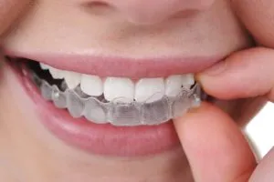 Busting Invisalign Myths
