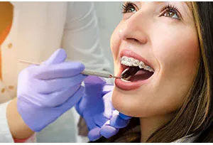 Orthodontics Treatment
