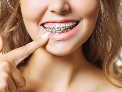 Tooth Extraction